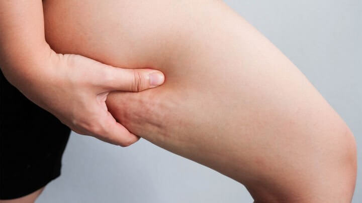 محصولات لاغری موضعی فوراور